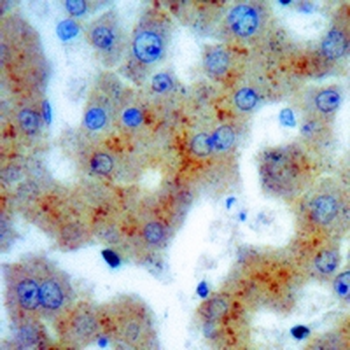 CD36 Rabbit Monoclonal Antibody