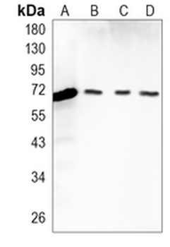 IGF2BP3 Rabbit Monoclonal Antibody