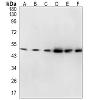 GLUD1 Rabbit Monoclonal Antibody