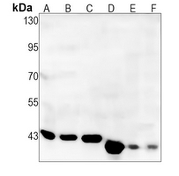 ILF2 Rabbit Monoclonal Antibody