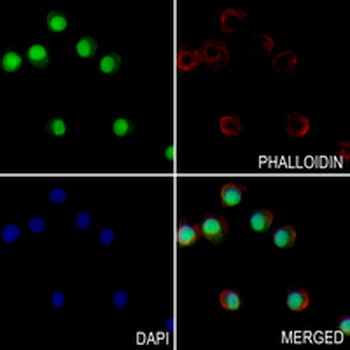 ILF2 Rabbit Monoclonal Antibody