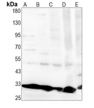 SNRPA Rabbit Monoclonal Antibody