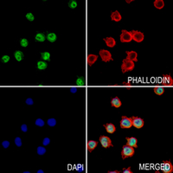 NR1D1 Rabbit Monoclonal Antibody