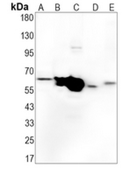 Alpha-internexin Rabbit Monoclonal Antibody