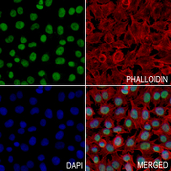 TFIIE-alpha Rabbit Monoclonal Antibody