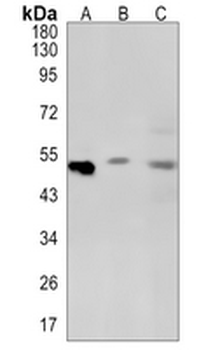 PPP2R5E Rabbit Monoclonal Antibody