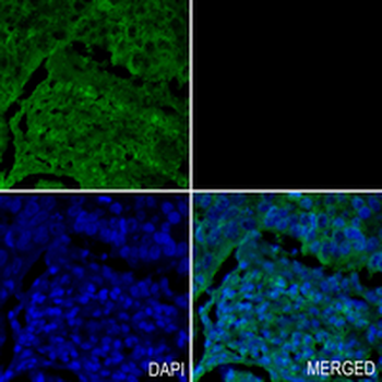 PPP2R5E Rabbit Monoclonal Antibody