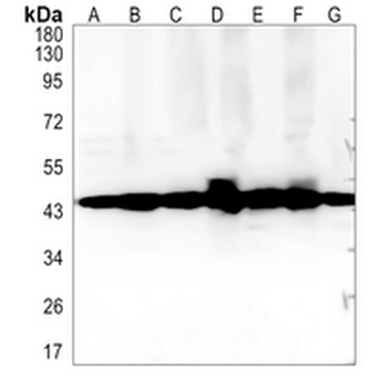 NDUFS2 Rabbit Monoclonal Antibody