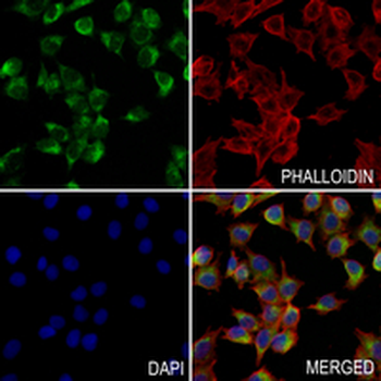 NDUFS2 Rabbit Monoclonal Antibody