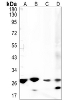 PSMB10 Rabbit Monoclonal Antibody