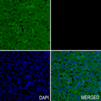 PSMB10 Rabbit Monoclonal Antibody
