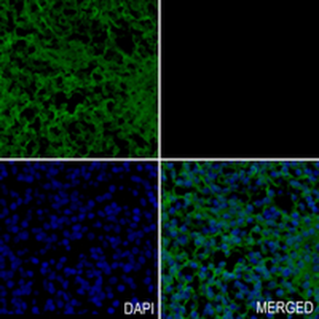 hnRNP E2 Rabbit Monoclonal Antibody