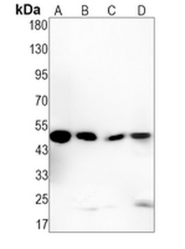 SNX5 Rabbit Monoclonal Antibody