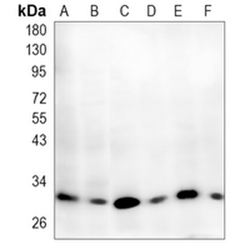 TMEM192 Rabbit Monoclonal Antibody