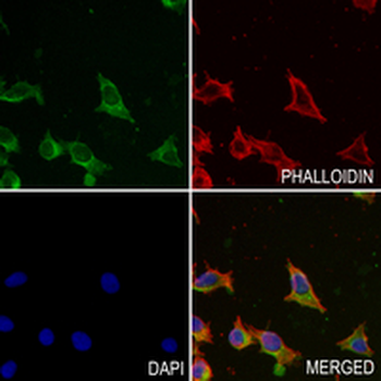 TMEM192 Rabbit Monoclonal Antibody