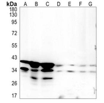 UFD1L Rabbit Monoclonal Antibody