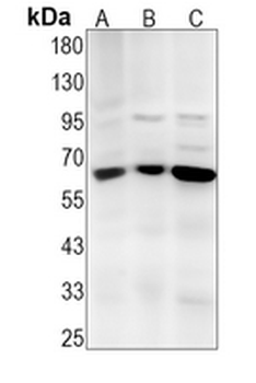 FPGS Rabbit Monoclonal Antibody