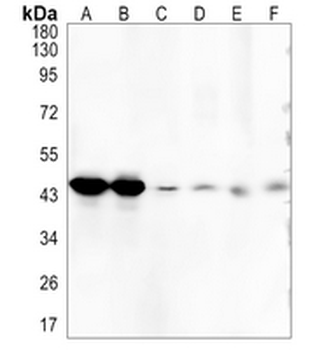 PSMC5 Rabbit Monoclonal Antibody