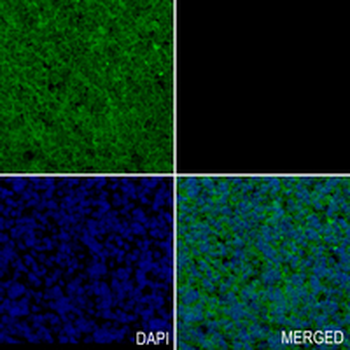 PSMC5 Rabbit Monoclonal Antibody