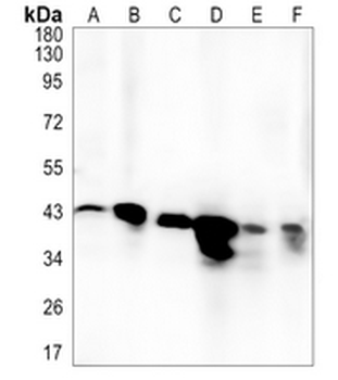 GALT Rabbit Monoclonal Antibody