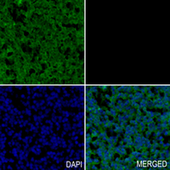 GALT Rabbit Monoclonal Antibody