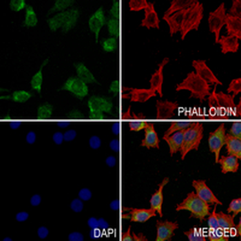 GALT Rabbit Monoclonal Antibody