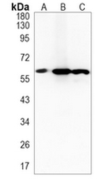 UAP1 Rabbit Monoclonal Antibody