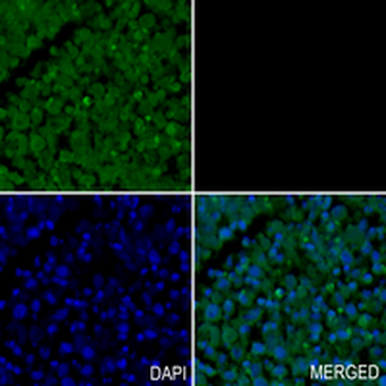 UAP1 Rabbit Monoclonal Antibody