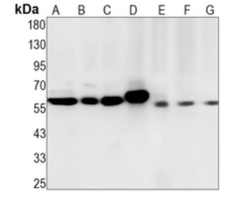ERGIC-53 Rabbit Monoclonal Antibody