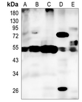 VDUP1 Rabbit Monoclonal Antibody