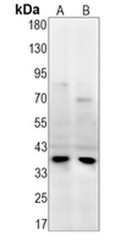 DDAH1 Rabbit Monoclonal Antibody