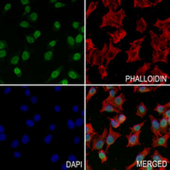 PFKFB3 Rabbit Monoclonal Antibody