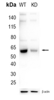 PFKFB3 Rabbit Monoclonal Antibody