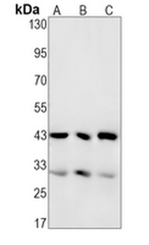 MBD2 Rabbit Monoclonal Antibody