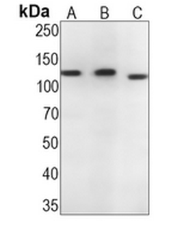 CD30 Rabbit Monoclonal Antibody