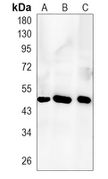 SMYD3 Rabbit Monoclonal Antibody