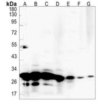 SF2 Rabbit Monoclonal Antibody