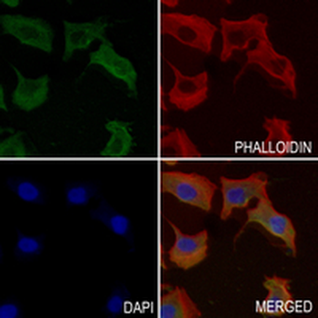 SF2 Rabbit Monoclonal Antibody