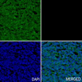 PCK2 Rabbit Monoclonal Antibody