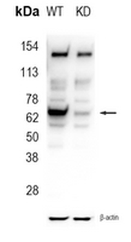 PCK2 Rabbit Monoclonal Antibody