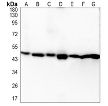 UQCRC2 Rabbit Monoclonal Antibody