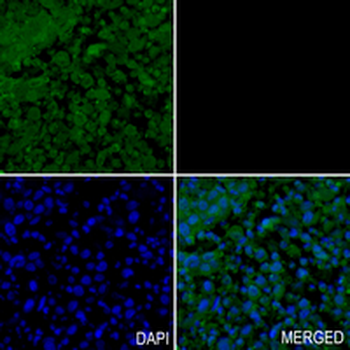 LOXL2 Rabbit Monoclonal Antibody