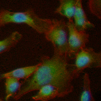 LOXL2 Rabbit Monoclonal Antibody