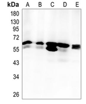 ELP3 Rabbit Monoclonal Antibody