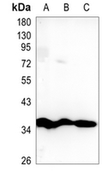 Thymidylate Synthase Rabbit Monoclonal Antibody