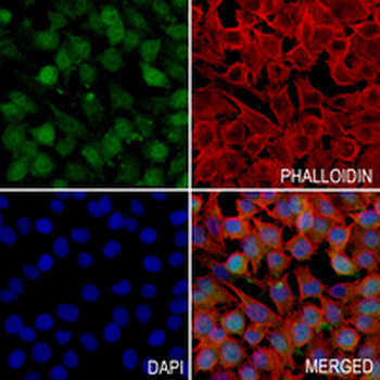Thymidylate Synthase Rabbit Monoclonal Antibody