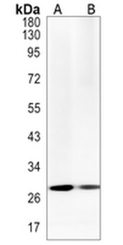 Calretinin Rabbit Monoclonal Antibody
