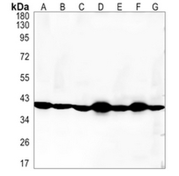 CCR8 Rabbit Monoclonal Antibody