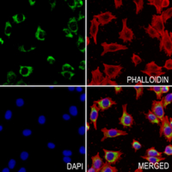 CCR8 Rabbit Monoclonal Antibody