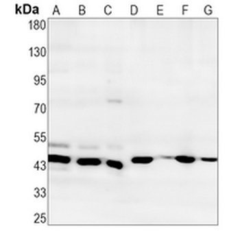 ATG4A Rabbit Monoclonal Antibody